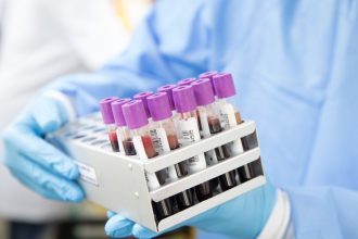 What Blood Tests Are Done on NHS Health Check
