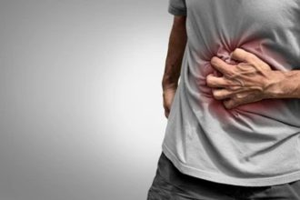 Crohn’s Disease