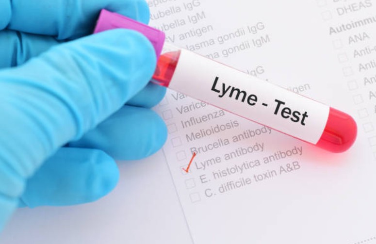Lyme Disease Is Diagnosed