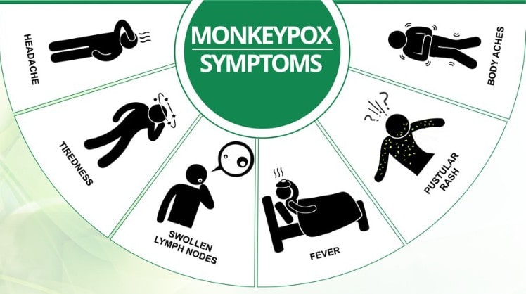 Symptoms of Monkeypox