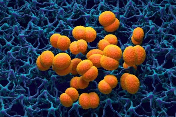 Meningitis
