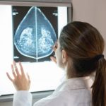 AI Cancer Prediction